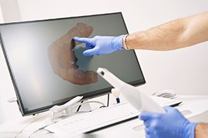 Gloved hand pointing at the results of digital impression scan