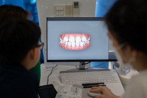 Dentist and patient looking at scan of teeth 