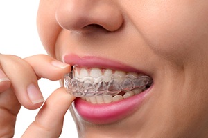 Nose-to-mouth closeup of woman inserting Invisalign over upper arch