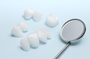 dental restorations