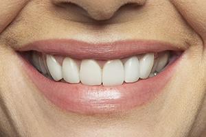 Closeup of healthy smile