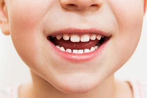 Closeup of kid's healthy smile