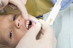 Child receiving fluoride treatment