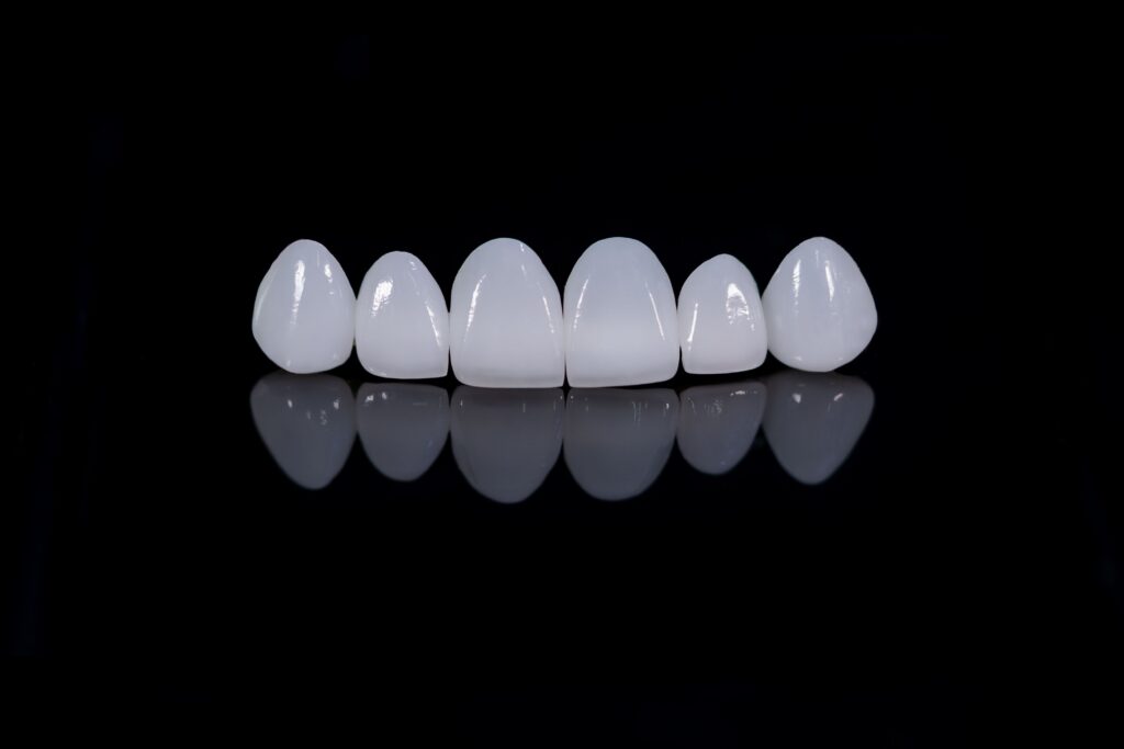 Set of temporary veneers on a reflective black surface